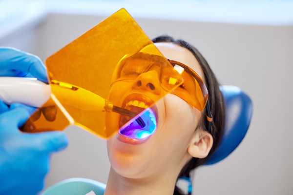 Dental Bonding And Teeth Whitening