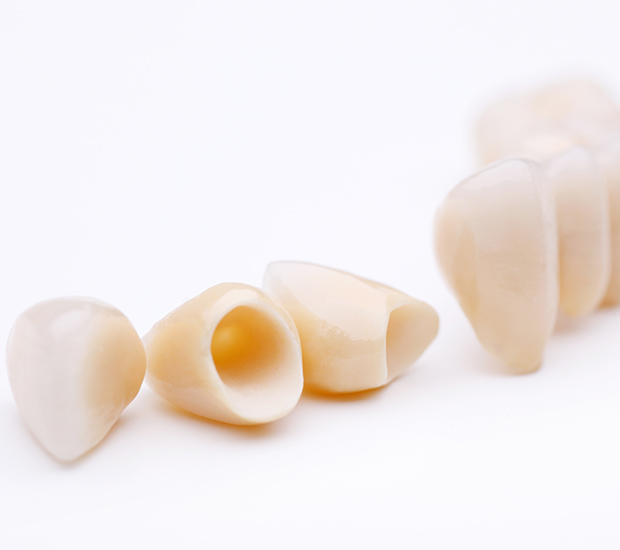 Chamblee Dental Crowns and Dental Bridges