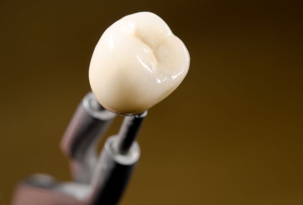 How Important Is Dental Crown Material Choice?