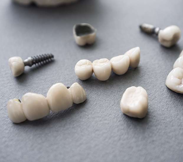 Chamblee The Difference Between Dental Implants and Mini Dental Implants