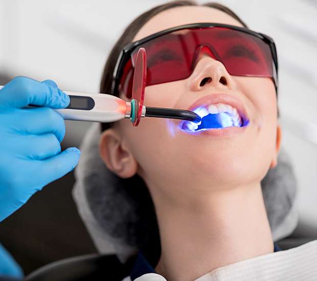 Chamblee Professional Teeth Whitening